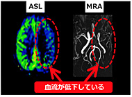 高画質なASL